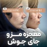 کلینیک زیبایی مانشید