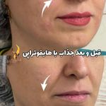 کلینیک زیبایی و مرکز لیزر هانیسا