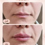 مرکز لیرز و جوانسازی پوست شهربانو