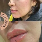 فیشال درمانی و پاکسازی پوست میرجلیلی