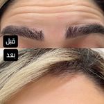 کلینیک پوست،زیبایی ولیزر اِلی(کندلا2025)