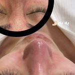 فیشال تخصصی و سالن پاکسازی پوست کامیابی