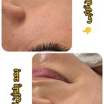 مرکز لیزر و فیشال دکتر خالقیان