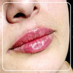 کلینیک پوست و لیزر ژینوس دکتر مقدم