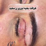 کلینیک زیبایی رز سفید