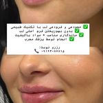 کلینیک لیزر و زیبایی مهسان