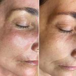 فیشال و اسکراپ اسکالپ عاطفه