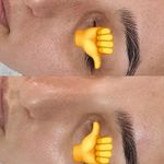 مرکز تخصصی فیشال و پاکسازی پوست تینا