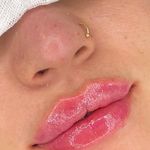 مرکز لیزر موهای زائد ماهور