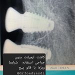 دندانپزشکی ایمپلنت و کلیه خدمات