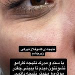خدمات تخصصی تتو و کاموفلاژ بانوان- تارا
