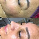 پاکسازی پوست محمودآباد - ریحانه