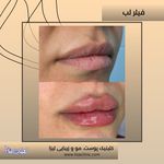 مطب پوست مو زیبایی فردوس شرق