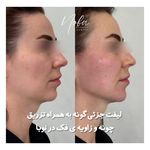 کلینیک زیبایی و لیزر مو زائد نوبا
