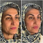 مطب زیبایی لیانارخ