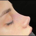 کلینیک زیبایی الماس کاملا اقساطی