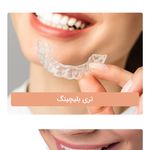 خدمات دندانسازی  ودندان مصنوعی ظفر