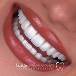 کلینیک دندانپزشکی هلسا(اقساط)