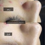 بیوتی تراپیست مژده حقیقت