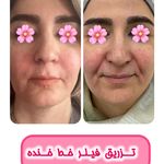 کلینیک پوست وزیبایی ومرکز تخصصی فیلربادی