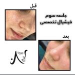 زیبایی نیلی