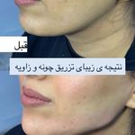 کلینیک لیزر پوست مو زیبایی الیزا شهرری