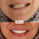 کلنیک دندانپزشکی ندا هادی شعبه اندرزگو
