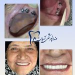 دندانپزشکی آریان بیمه تکمیلی با بیهوشی