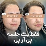 کلینیک زیبایی مانشید