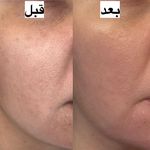 کلینیک پوست و مو الیزا