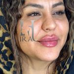 کلینیک زیبایی و لیزر هیرا