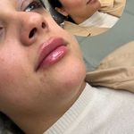 کلینیک لیزر و زیبایی مهرُنا