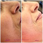 سالن زیبایی مهلقا