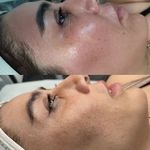 فیشال و خدمات پاکسازی پوست  فاطمه انامی