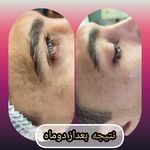 مطب پوست ،مو و لیزر یسنا طب