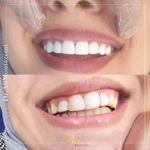 دندانپزشکی دکتر علی منتظمی (بیمه نداریم)