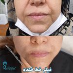 مرکز تخصصی لیزر و زیبایی سعادت آباد