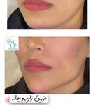 کلینیک پوست و مو و لیزر نیلوفر آبی