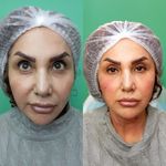 کلینیک زیبایی پارسیان آلفا