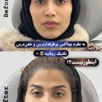 کلینیک زیبایی و جوانسازی پوست و مو الین