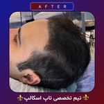 اولین مرکز میکرواسکالپ مشهد تاپ اسکالپ