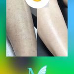 کلینیک تخصصی پوست و زیبایی ملینا