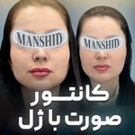 کلینیک زیبایی مانشید