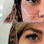 کلینیک زیبایی و لیزر هیرا