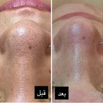 پاکسازی پوست و مو مهسام