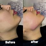 مطب زیبایی خانم محمدرضایی پوست ومو