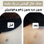 مرکز لیزر الماس