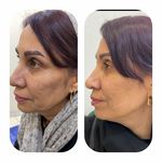 کلینیک تخصصی ژل و بوتاکس مرضیه آقابابایی