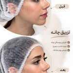 مرکز لیزر ،پوست و زیبایی کندی بیوتی