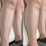 مرکز لیزر و کلینیک زیبایی آروین